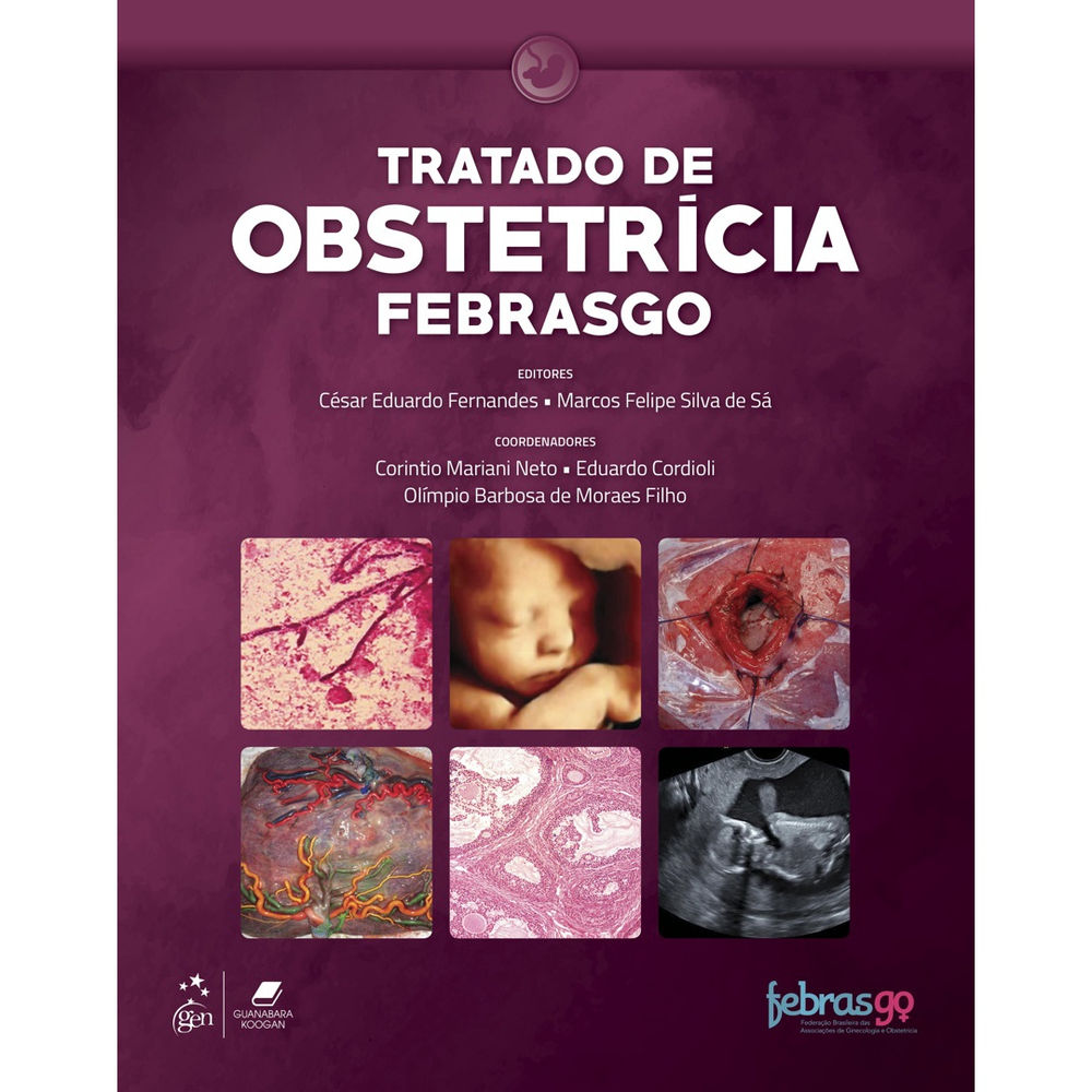 Livro Febrasgo Tratado de Obstetrícia no Shoptime