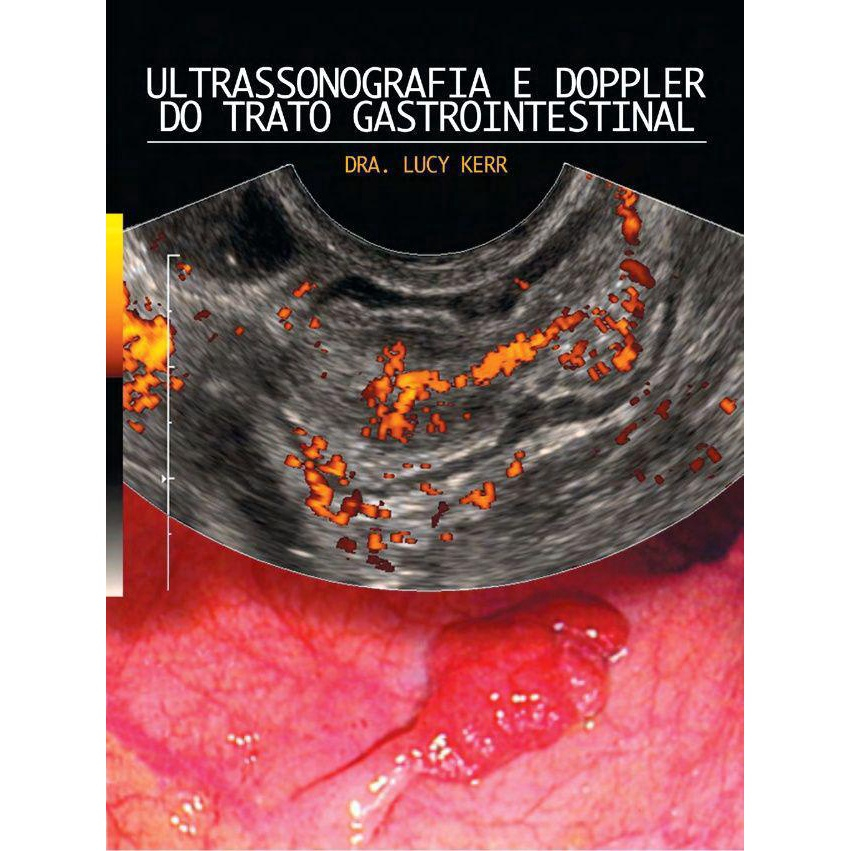 Livro Ultrassonografia E Doppler Do Trato Gastrointestinal em Promoção