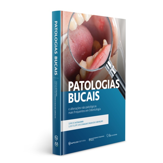 Patologias Bucais E Altera Es N O Patol Gicas Mais Frequentes Em