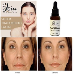 100% Puro Ácido Hialurônico 30ml Original Skin Health Menor preço em 100% Puro Ácido Hialurônico 30ml Original Skin Health