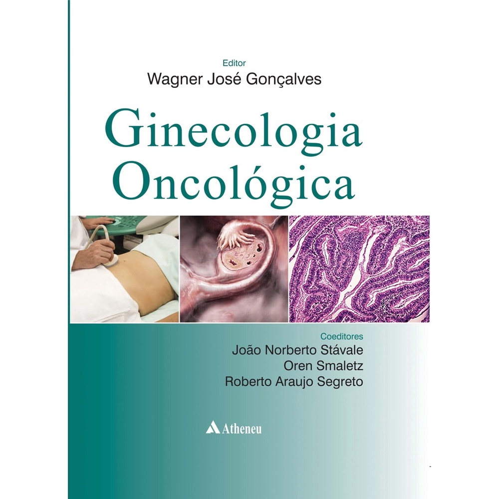 Livro - Ginecologia oncológica em Promoção | Ofertas na Americanas