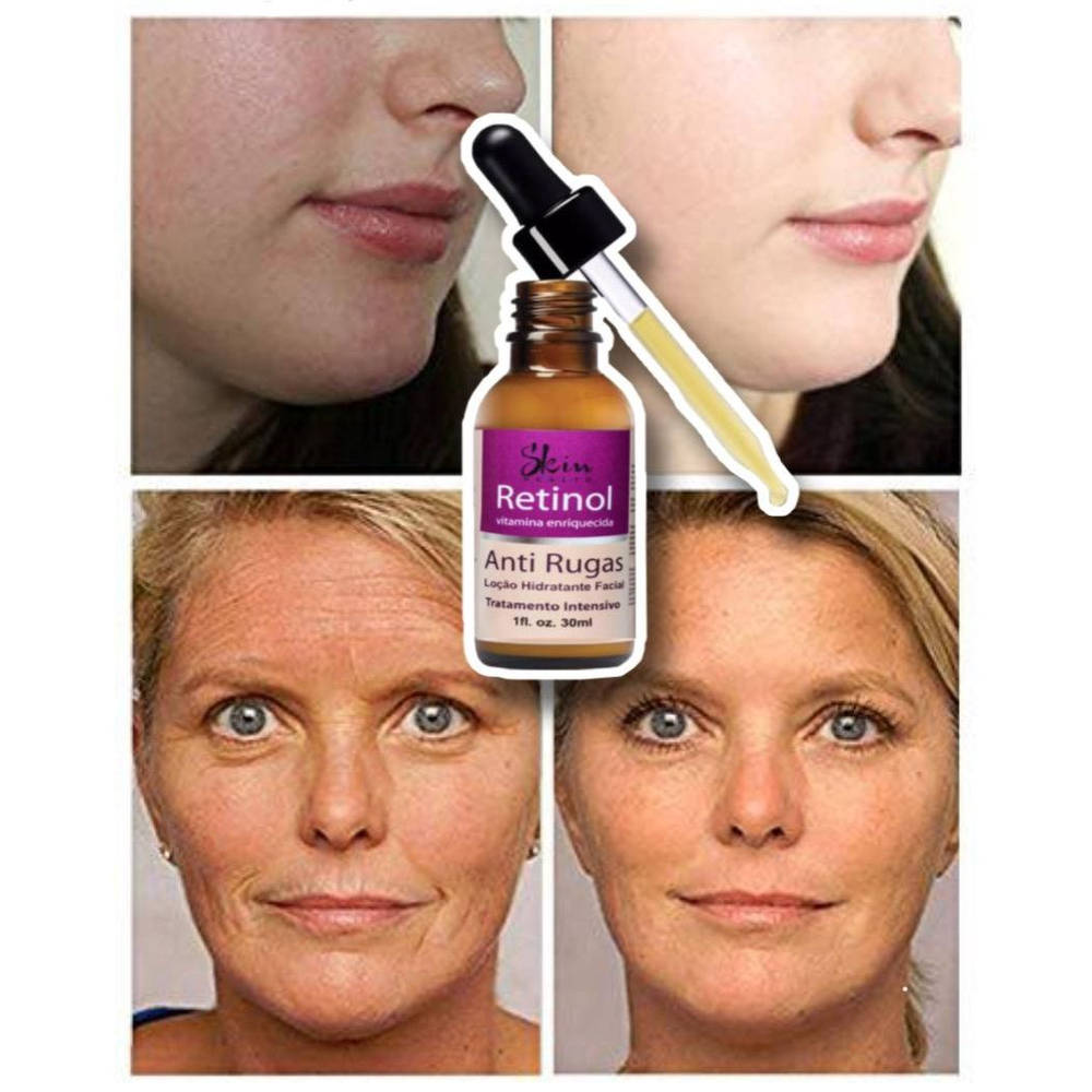 RETINOL  ENTENDA O QUE É E PRA QUE SERVE #resenhasdaingrid 