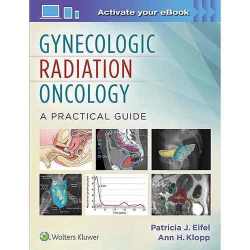 Livro Gynecologic Radiation Oncology Em Promoção | Ofertas Na Americanas