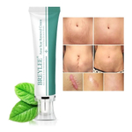 Tratamento Para Pele Cicatriz Cirurgias Estrias Breylee 30g