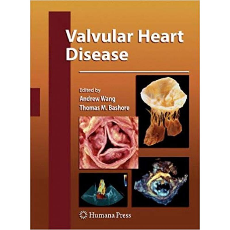 Valvular Heart Disease | Submarino