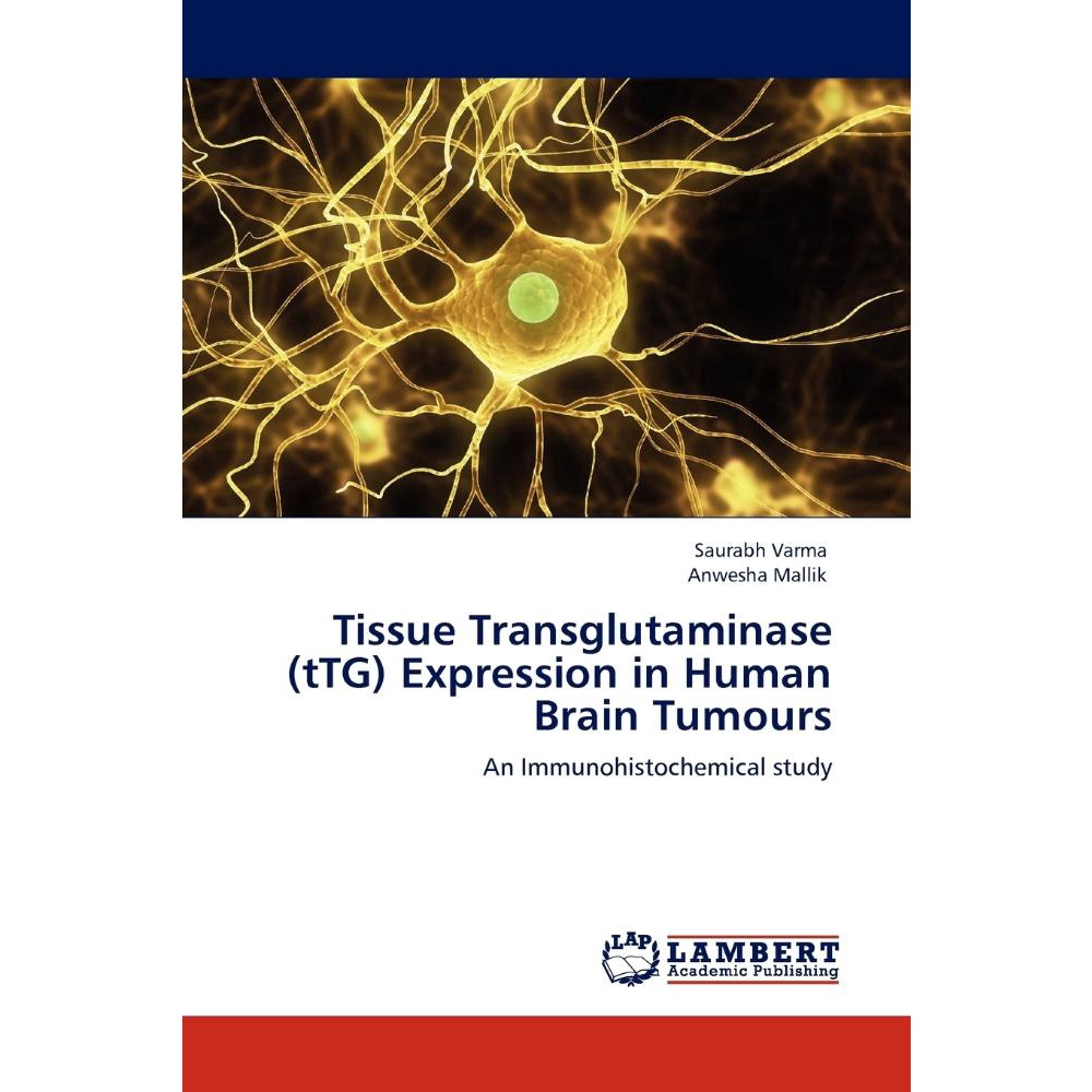 Tissue Transglutaminase Ttg Expression In Human Brain Tum Em Promoção