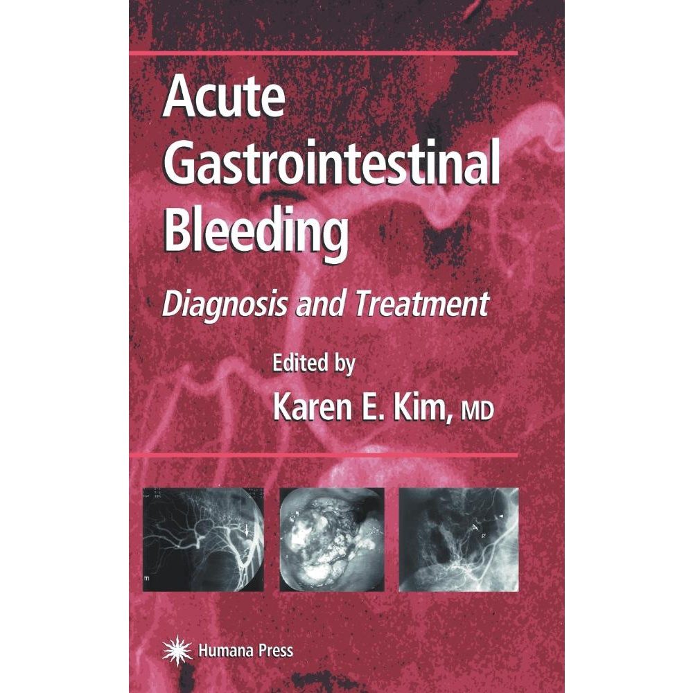 Acute Gastrointestinal Bleeding Em Promoção Na Americanas