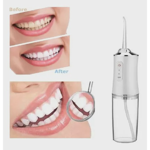 Jato D Gua Irrigador Limpador Bocal Dental Dentes Gengiva Oral