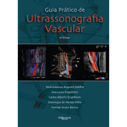 Livro: guia prático de ultrassonografia vascular Menor preço em Livro: guia prático de ultrassonografia vascular