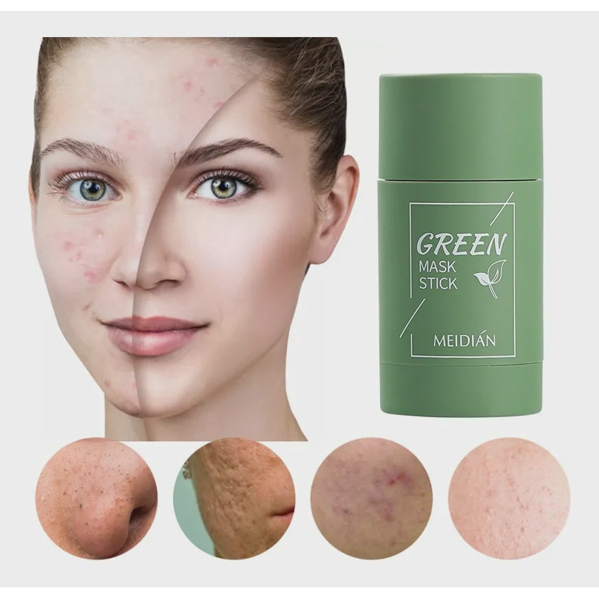 Green Mask Stick Limpeza Pele Tira Remove Acne em Promoção | Ofertas na ...