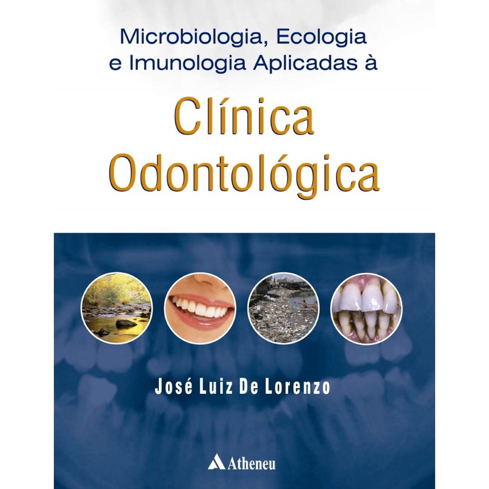 Microbiologia, Ecologia E Imunologia Aplicadas à Clínica Odontológica ...