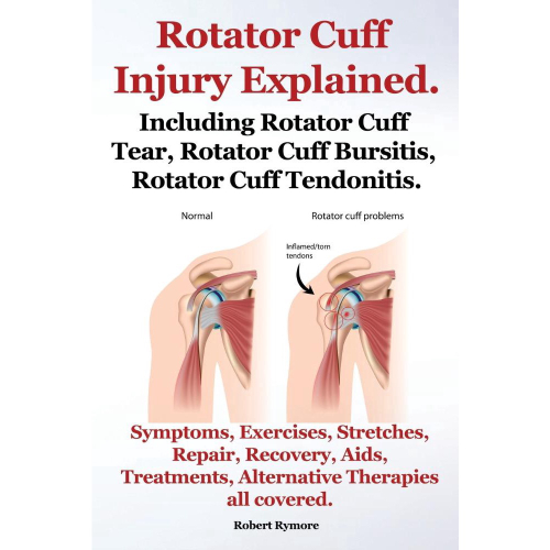 Rotator Cuff Injury Explained. Including Rotator Cuff Tear, Rotator